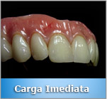 Carga Imediata