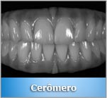 Cerômero