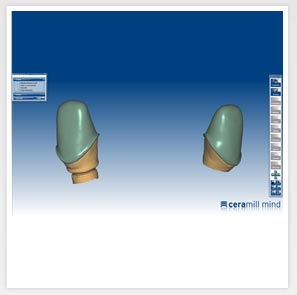 Copings sobre implantes