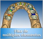 Prótese sobre implante