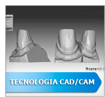 Sistema CAD/CAM